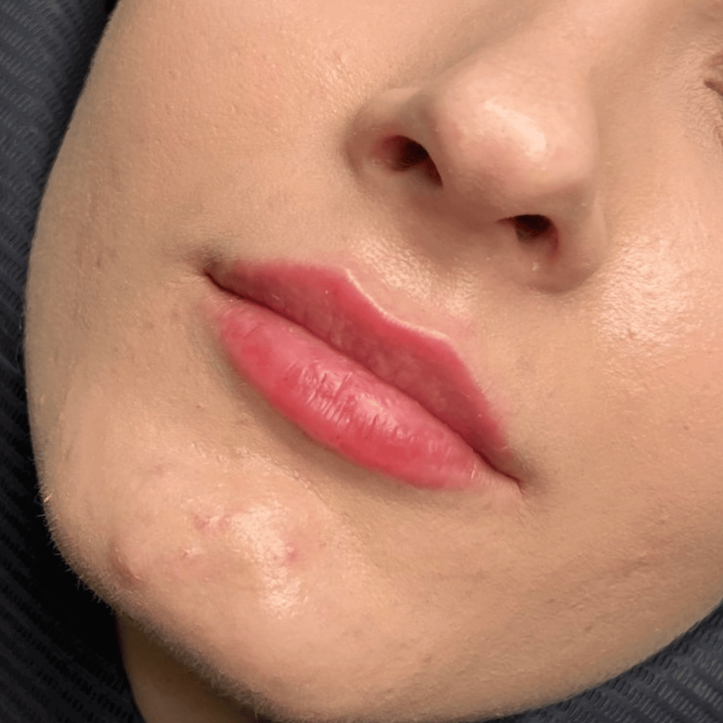 modelowanie ust kłodzko opalona kosmetologia